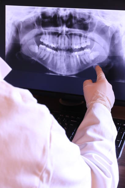 Best Emergency Dental Care for Abscessed Tooth in Chester Center, CT